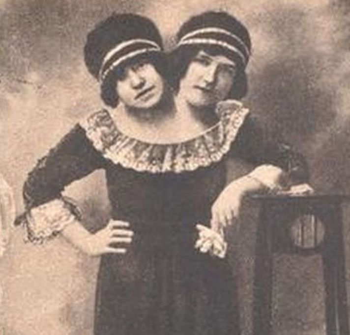 Two-Headed Sister
